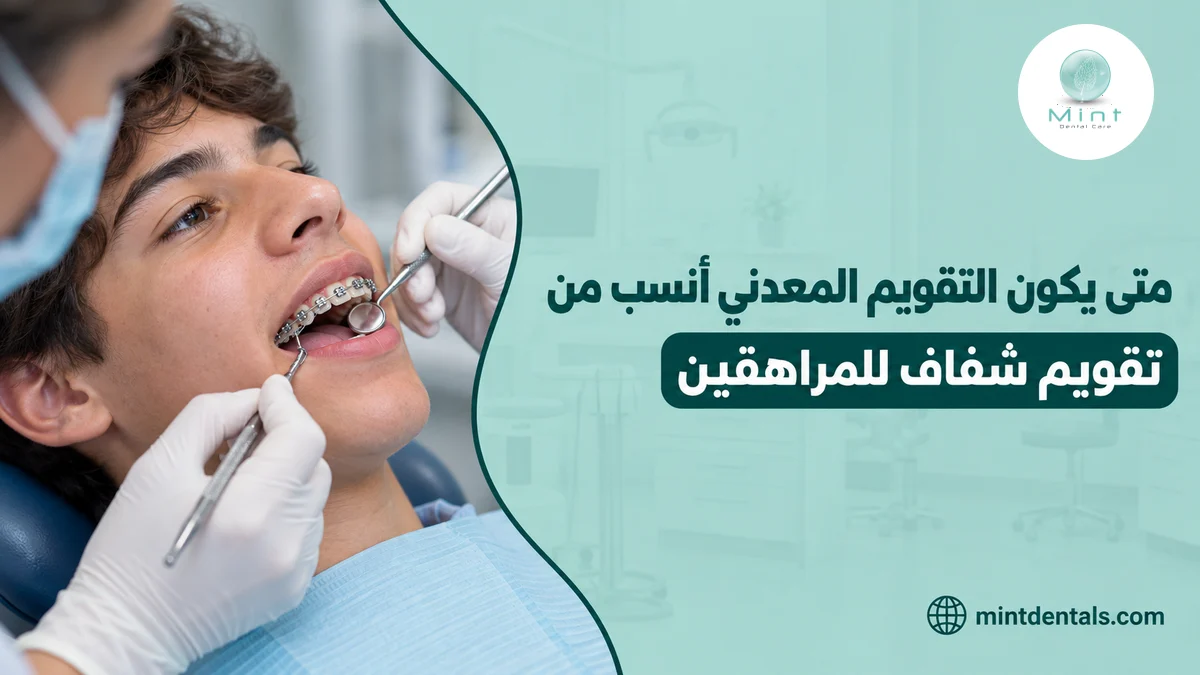 متى يكون التقويم المعدني أنسب من تقويم شفاف للمراهقين