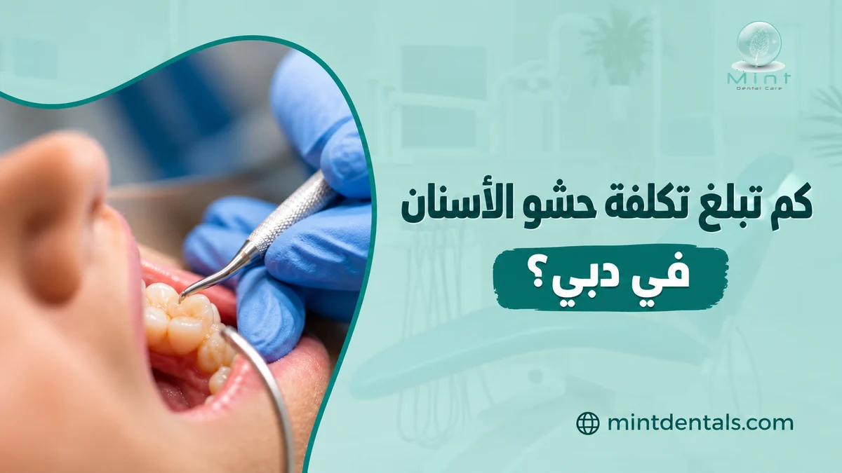 كم تبلغ تكلفة حشو الأسنان في دبي