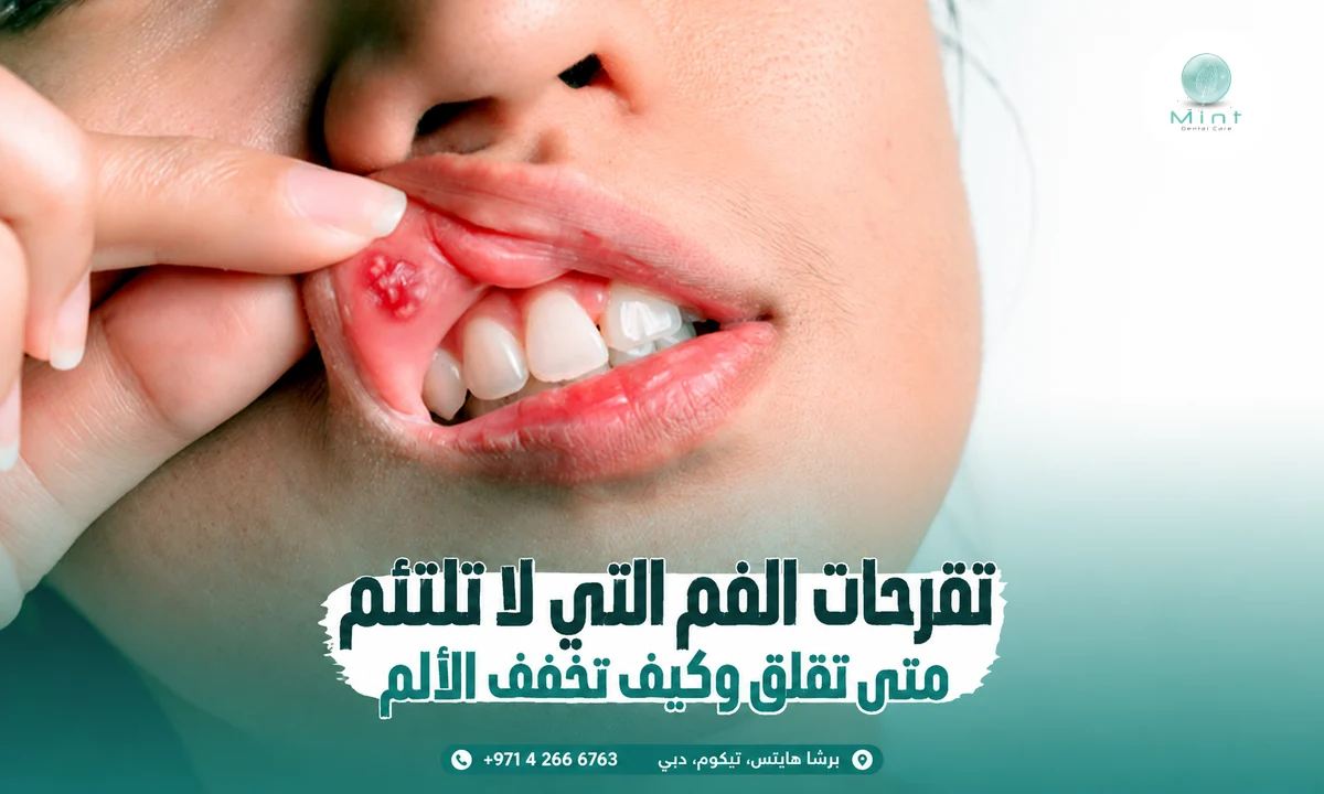 تقرحات الفم التي لا تلتئم: متى تقلق وكيف تخفف الألم