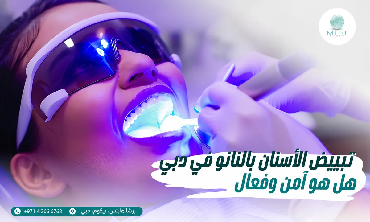 تبييض الأسنان بالنانو في دبي: هل هو آمن وفعال
