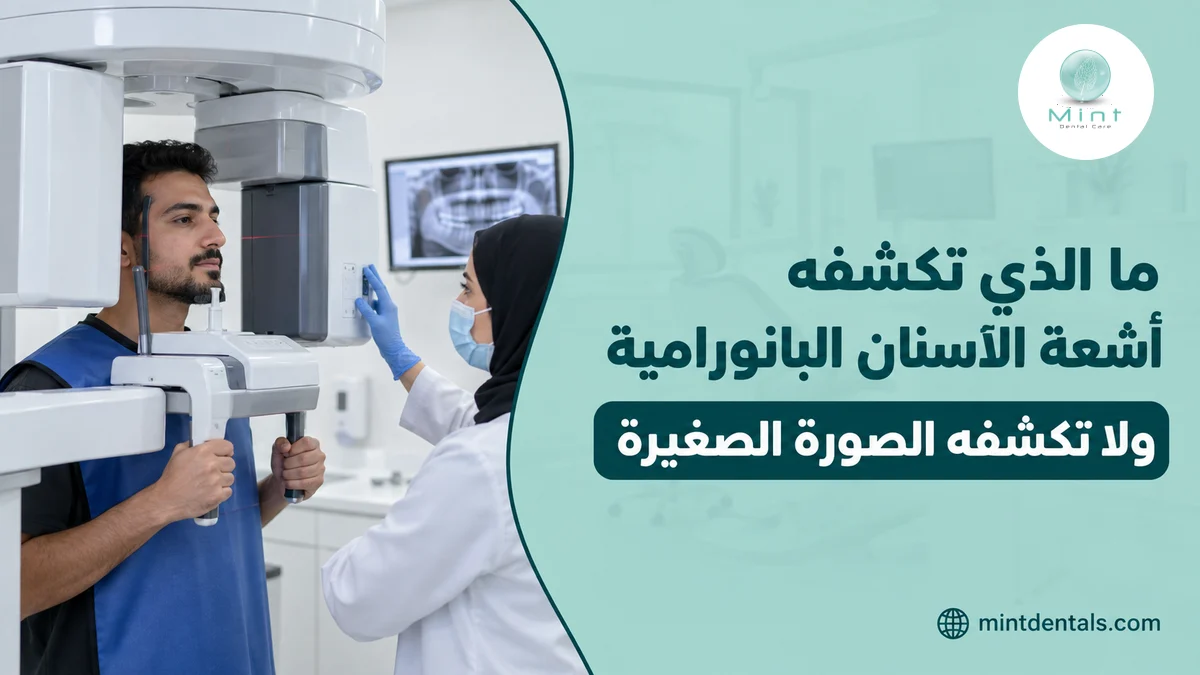 ما الذي تكشفه أشعة الأسنان البانورامية ولا تكشفه الصورة الصغيرة