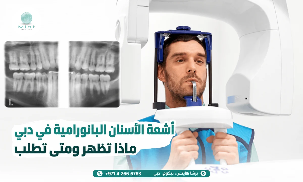أشعة الأسنان البانورامية في دبي: ماذا تظهر ومتى تطلب