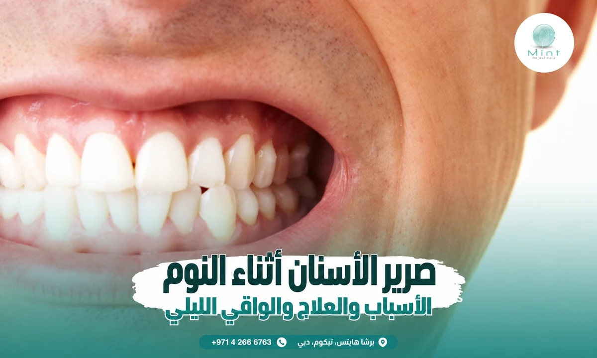 صرير الأسنان أثناء النوم: الأسباب والعلاج والواقي الليلي