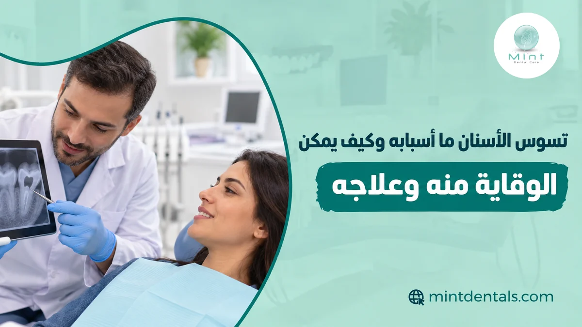 تسوس الأسنان ما أسبابه وكيف يمكن الوقاية منه وعلاجه