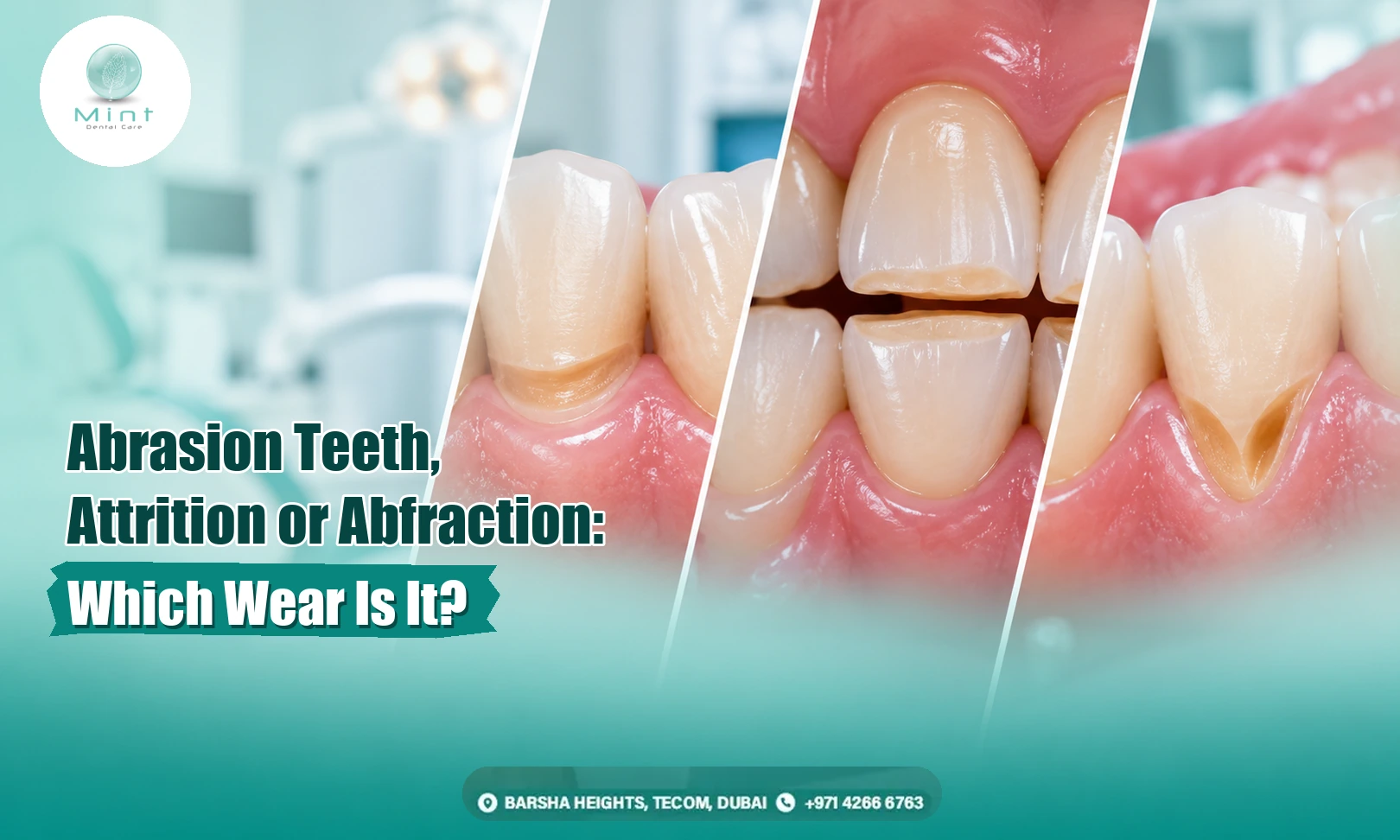 Abrasion Teeth