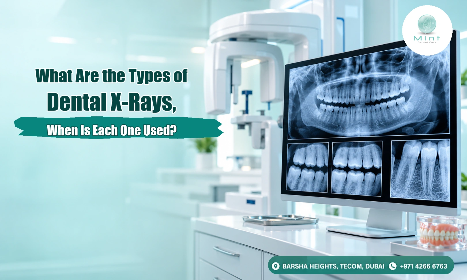 Dental x-rays