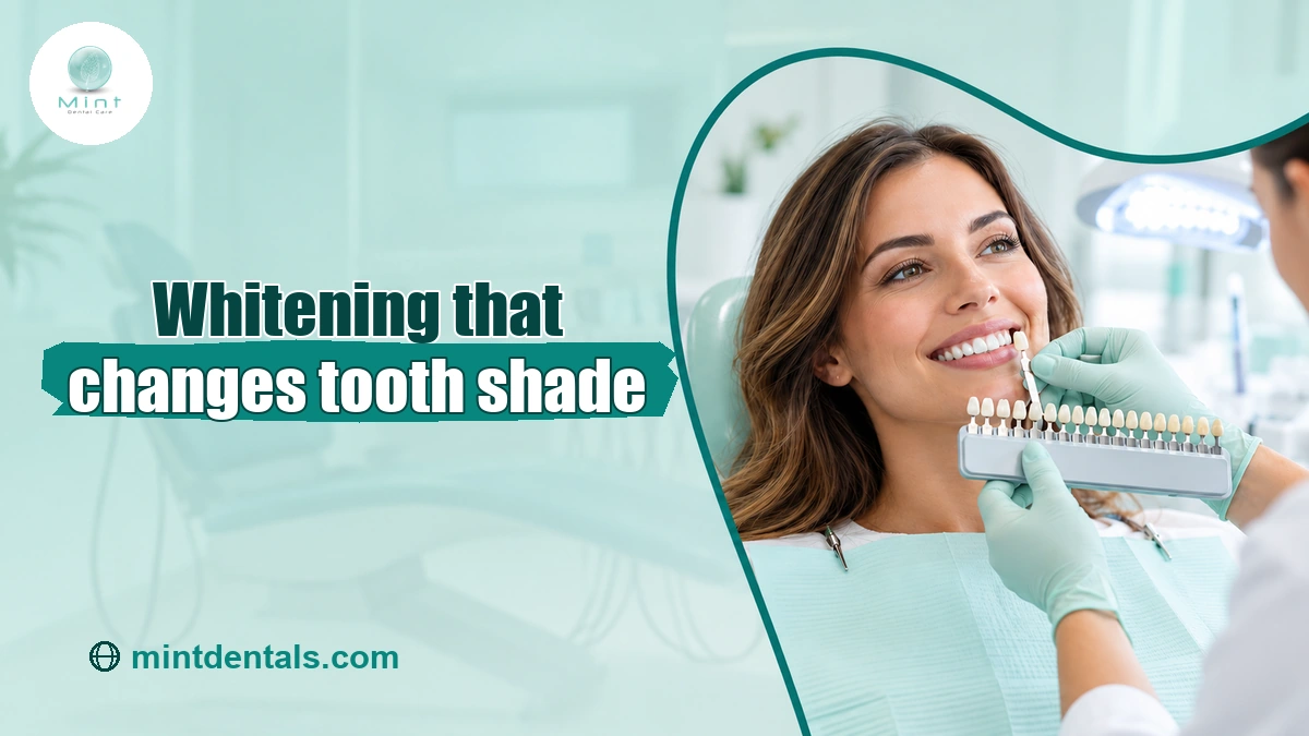 Dentist comparing tooth shades after professional whitening
