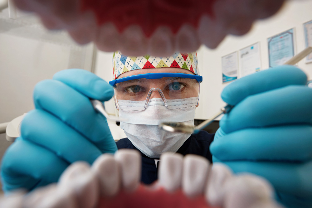 Dental scan used for CBCT scan implant planning