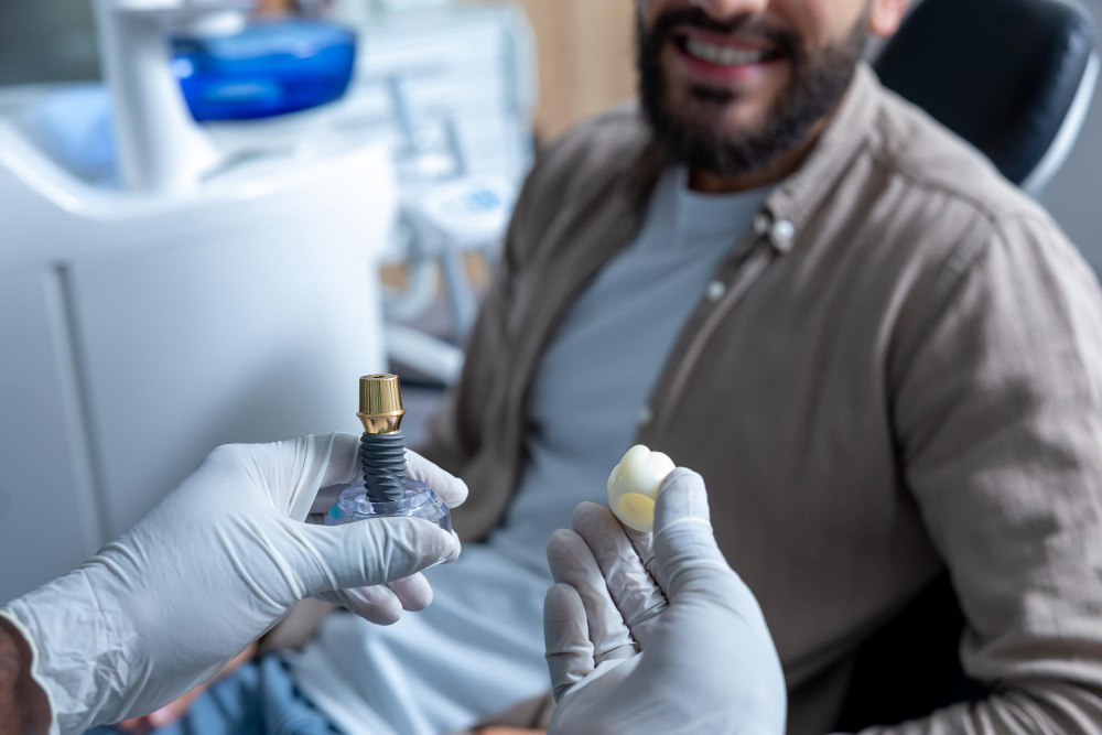 What are All-on-4 dental implants