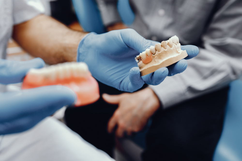 What Is a Dental Implant?
