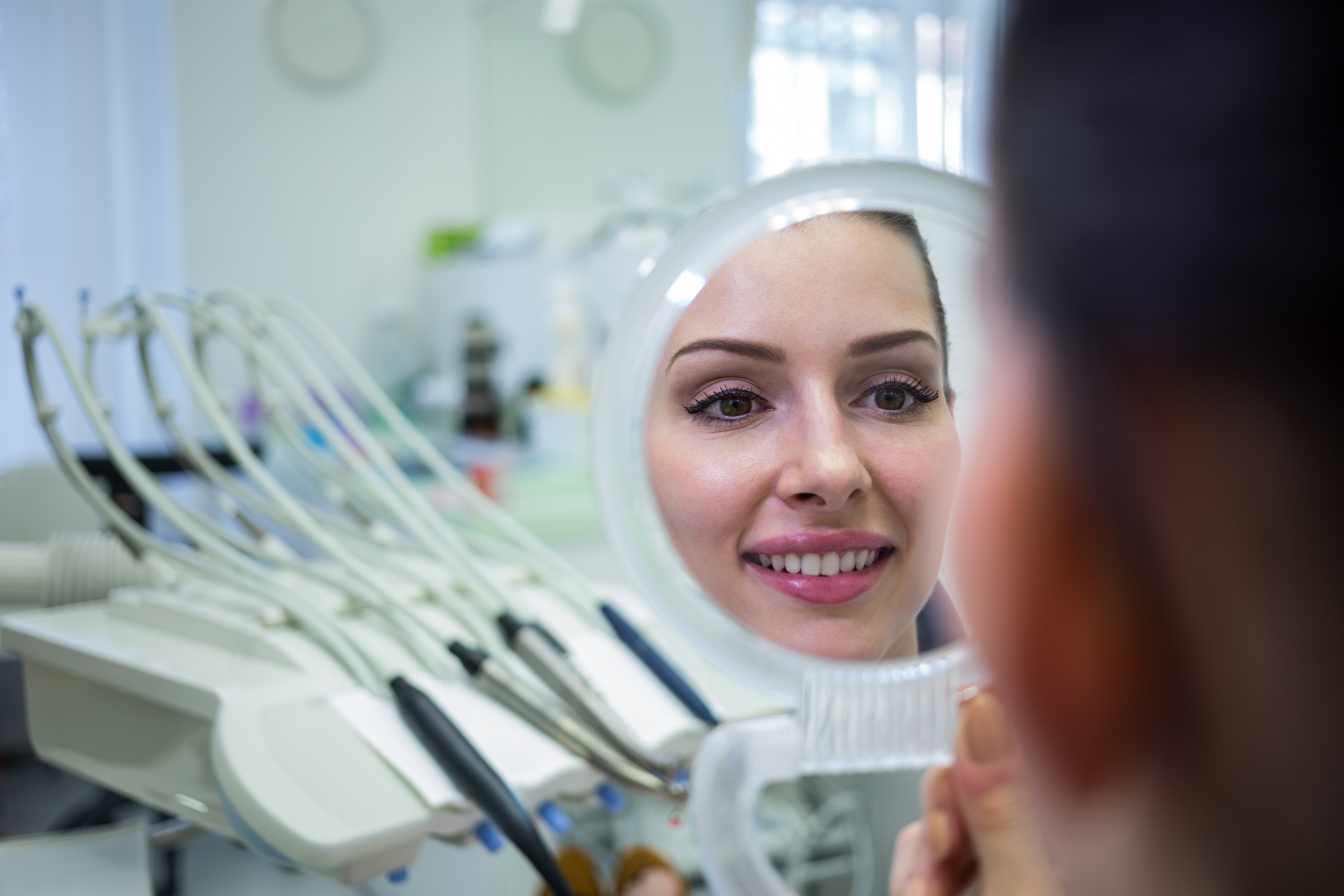 Home Teeth Whitening