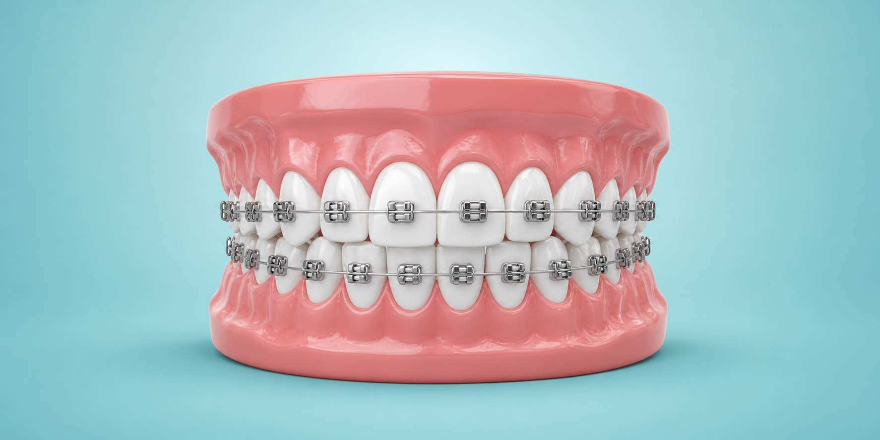 Braces