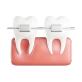 Brace