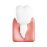 Premolar